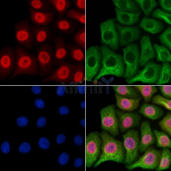 HSPB8 Antibody - DF2481 staining Hela cells by IF/ICC.