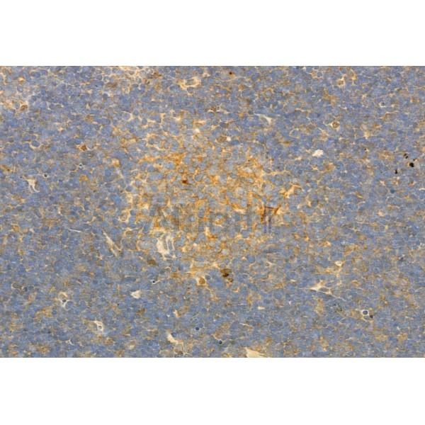 PLCE1 Antibody - DF2565 at 1/100 staining Rat thymus tissue by IHC-P.