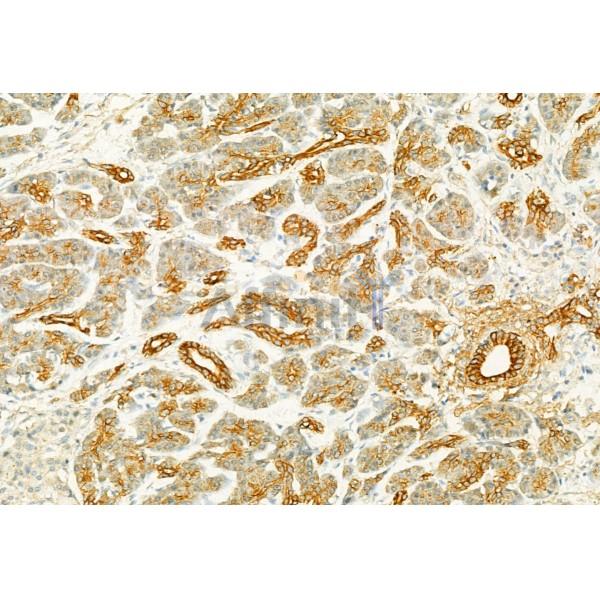 PLCE1 Antibody - DF2565 at 1/100 staining Human normal tissues adjacent to pancreatic cancer by IHC-P.