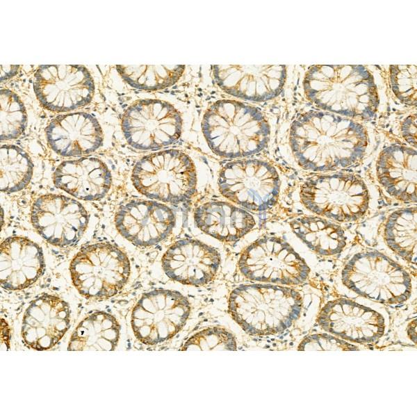 PLCE1 Antibody - DF2565 at 1/100 staining Human normal tissues adjacent to colorectal cancer by IHC-P.