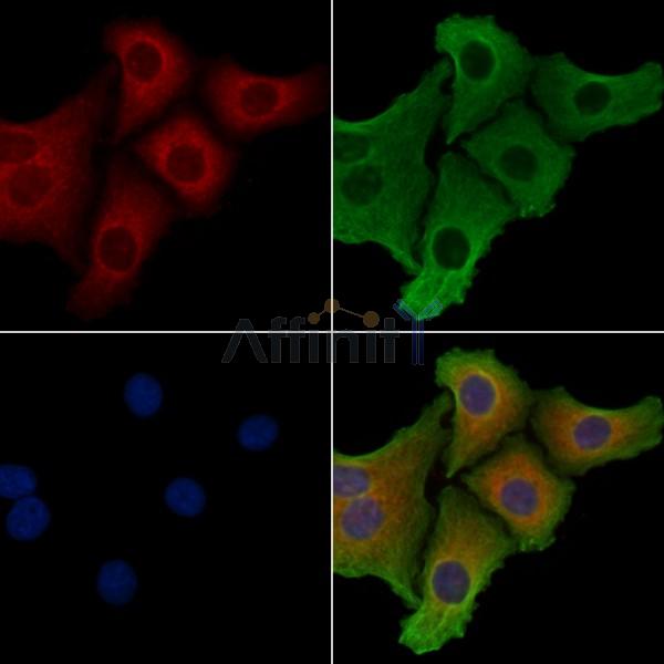 C9orf156 Antibody - DF2619 staining Hela cells by IF/ICC.