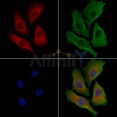 DYRK4 Antibody - DF2665 staining Hela cells by IF/ICC.