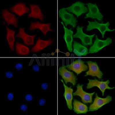 GPR128 Antibody - DF2722 staining Hela cells by IF/ICC.