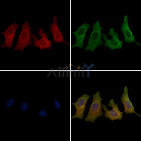 GPR62 Antibody - DF2756 staining HepG2 cells by IF/ICC.