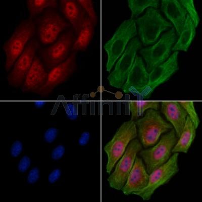 GPR88 Antibody - DF2812 staining Hela cells by IF/ICC.
