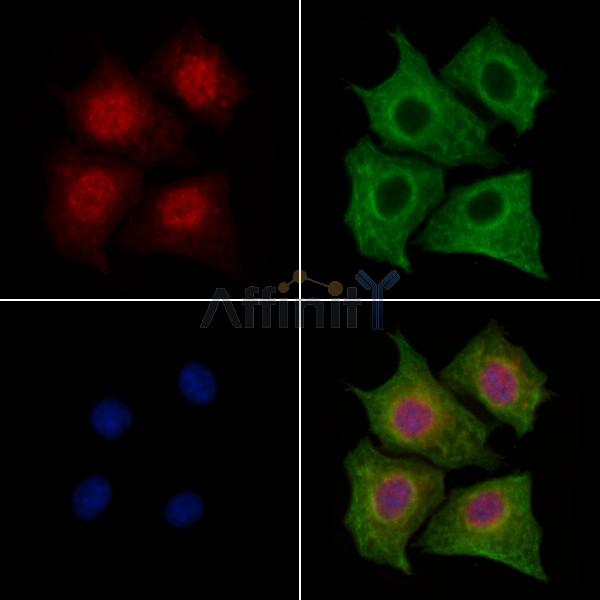 LMO4 Antibody - DF3223 staining HepG2 cells by IF/ICC.