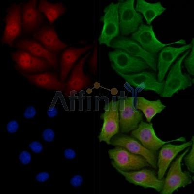 TSSC1 Antibody - DF3314 staining Hela cells by IF/ICC.