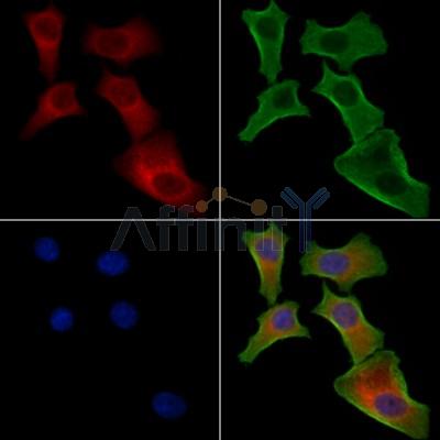 ES8L1 Antibody - DF3367 staining Hela cells by IF/ICC.