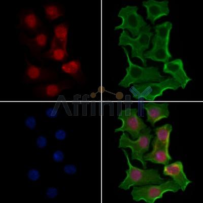API-5 Antibody - DF3515 staining Hela cells by IF/ICC.