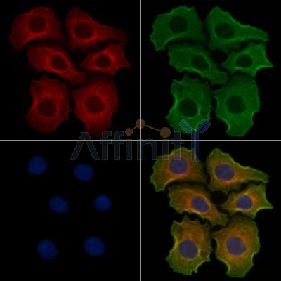 TROVE2 Antibody - DF3693 staining Hela cells by IF/ICC.