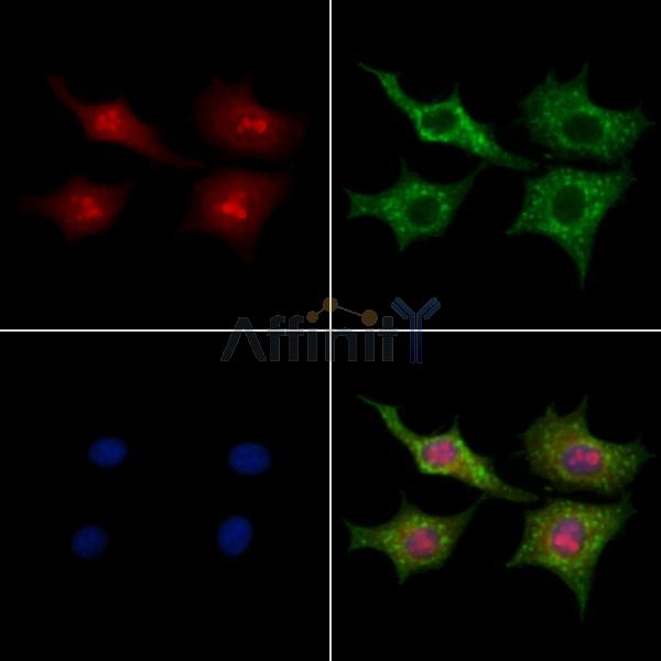 DDX55 Antibody - DF3821 staining HepG2 cells by IF/ICC.