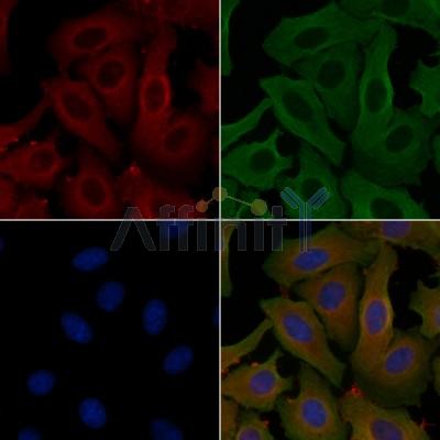 CAPN11 Antibody - DF3867 staining Hela cells by IF/ICC.