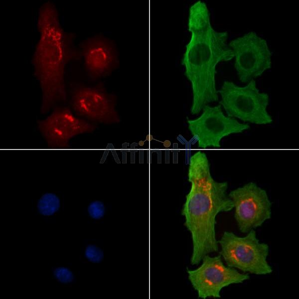 CNTN6 Antibody - DF3970 staining Hela cells by IF/ICC.