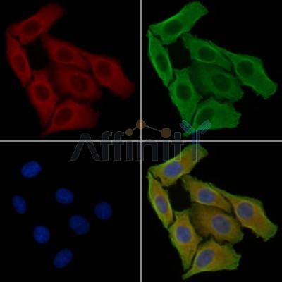 CXADR Antibody - DF3973 staining Hela cells by IF/ICC.
