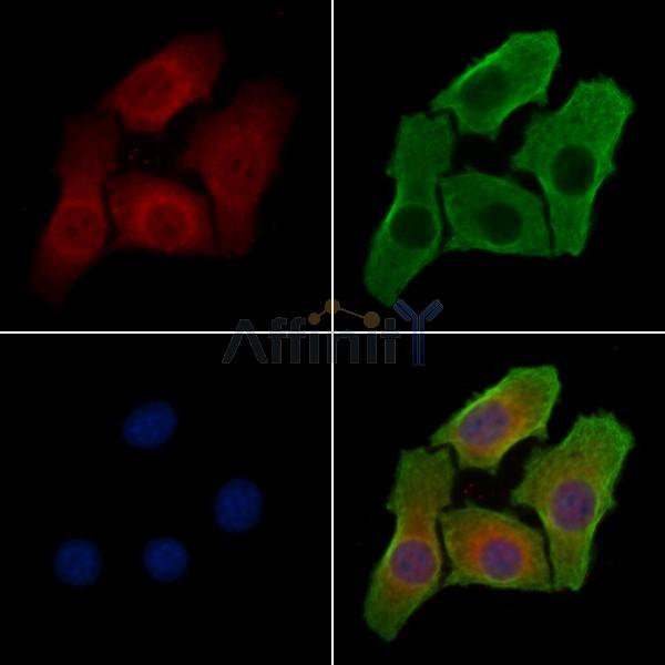 DHPS Antibody - DF3987 staining Hela cells by IF/ICC.