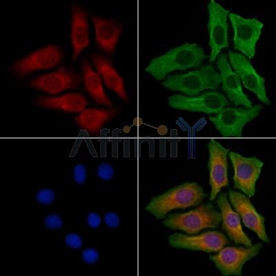 DNAJB11 Antibody - DF4010 staining Hela cells by IF/ICC.