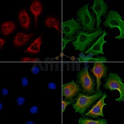 DNAL1 Antibody - DF4014 staining Hela cells by IF/ICC.