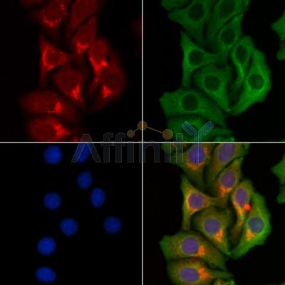 UBR1 Antibody - DF4029 staining Hela cells by IF/ICC.