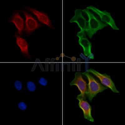 ELOVL5 Antibody - DF4038 staining Hela cells by IF/ICC.