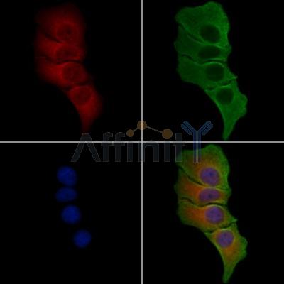 TUBGCP4 Antibody - DF4075 staining Hela cells by IF/ICC.