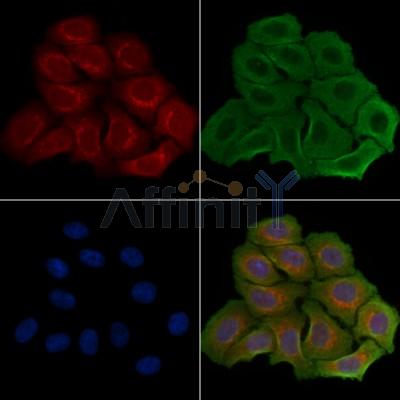 GIDRP88 Antibody - DF4095 staining Hela cells by IF/ICC.