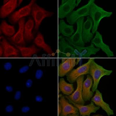 CEP97 Antibody - DF4137 staining Hela cells by IF/ICC.