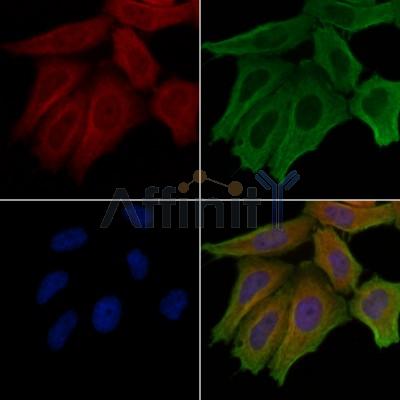 LIPI Antibody - DF4141 staining Hela cells by IF/ICC.