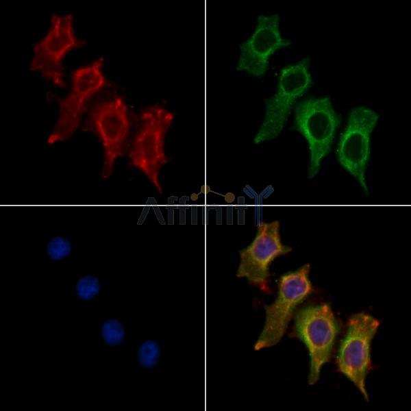 LDLRAD1 Antibody - DF4143 staining HepG2 cells by IF/ICC.