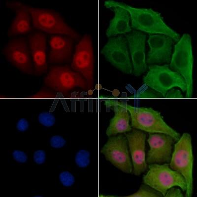 MAD2L1BP Antibody - DF4150 staining Hela cells by IF/ICC.
