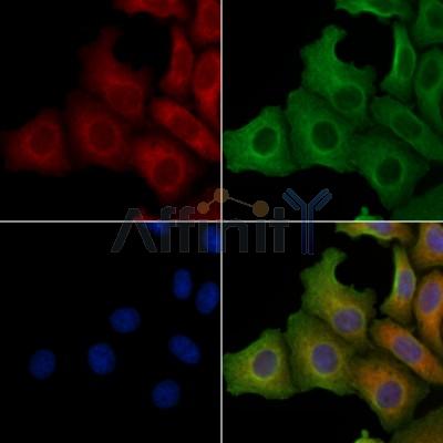 SLC25A11 Antibody - DF4173 staining Hela cells by IF/ICC.