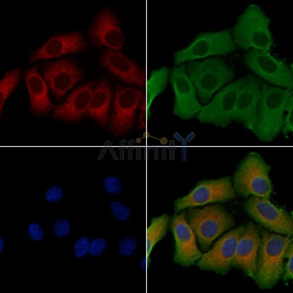 CYB5R3 Antibody - DF4212 staining Hela cells by IF/ICC.