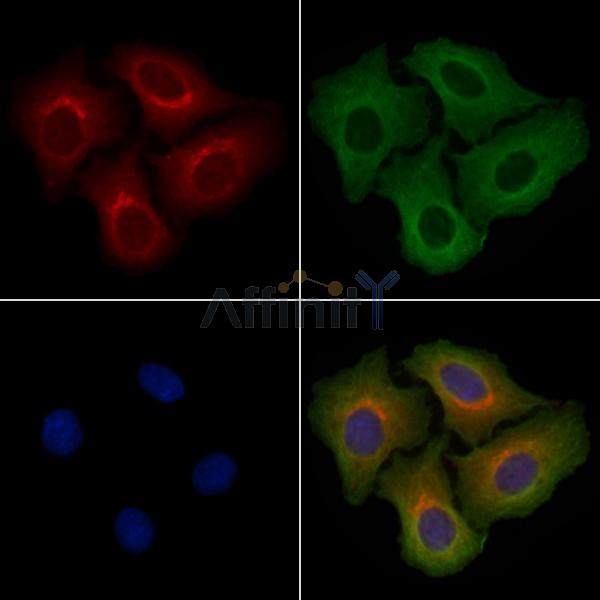 PTGR1 Antibody - DF4216 staining Hela cells by IF/ICC.