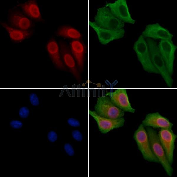 NCOA7 Antibody - DF4256 staining Hela cells by IF/ICC.