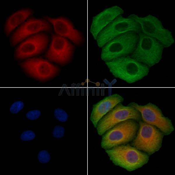 SNX3 Antibody - DF4537 staining Hela cells by IF/ICC.
