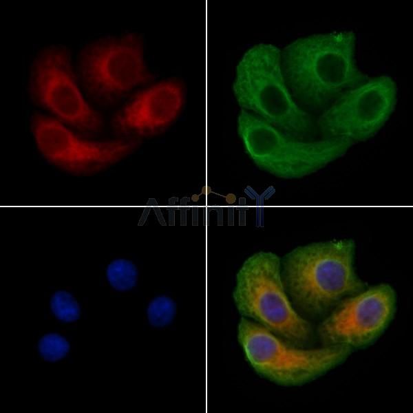 SNX4 Antibody - DF4538 staining Hela cells by IF/ICC.