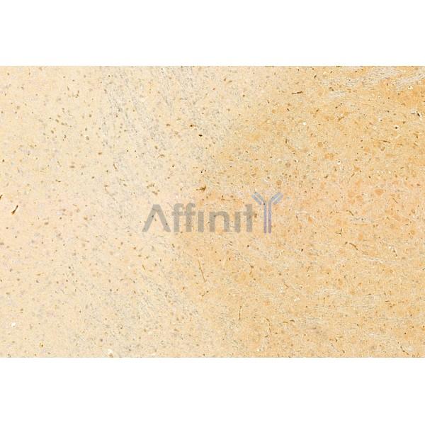 SirT1 Antibody - DF6033 at 1/100 staining Mouse brain tissue by IHC-P.