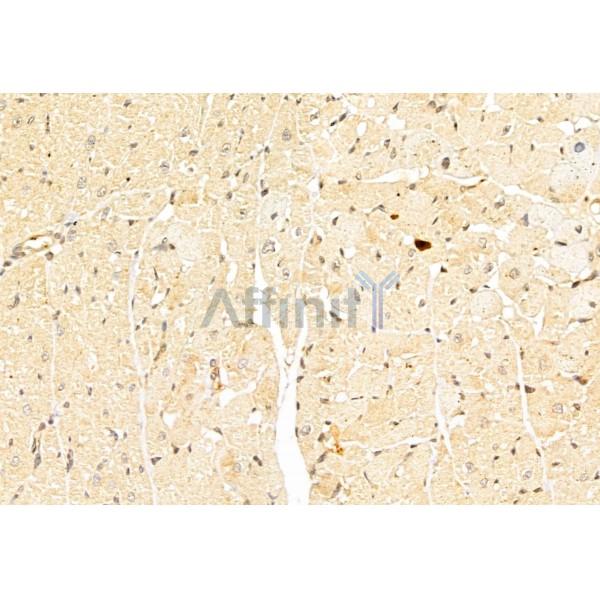 SirT1 Antibody - DF6033 at 1/100 staining Rat heart tissue by IHC-P.