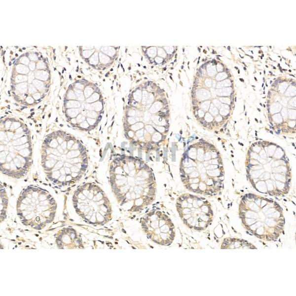 SirT1 Antibody - DF6033 at 1/100 staining Human normal tissues adjacent to colorectal cancer by IHC-P.