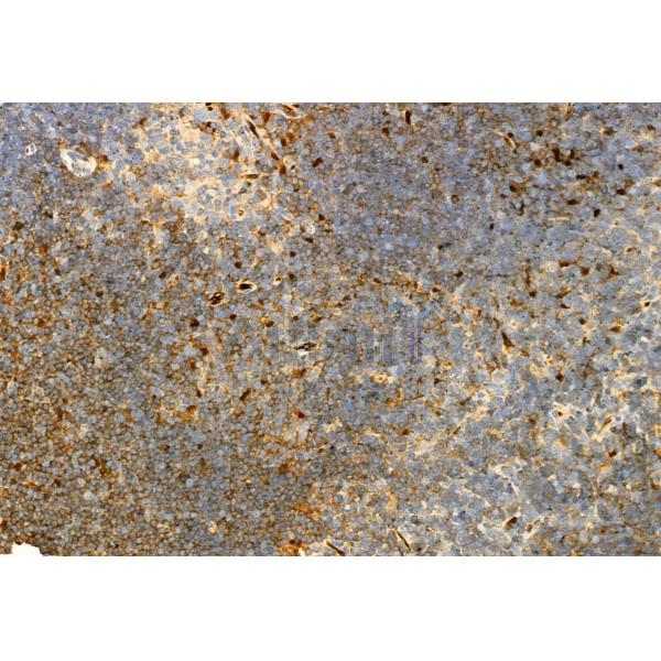 IL6 Antibody - DF6087 at 1/100 staining Mouse thymus tissue by IHC-P.