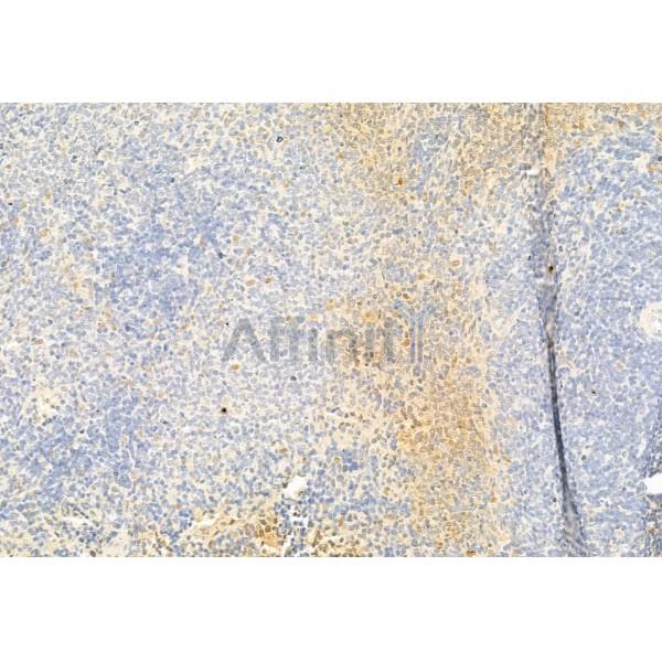 DRP1 Antibody - DF7037 at 1/100 staining Rat spleen tissue by IHC-P.