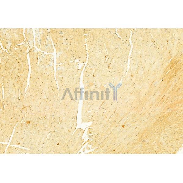 NLRP3 Antibody - DF7438 at 1/100 staining Mouse heart tissue by IHC-P.