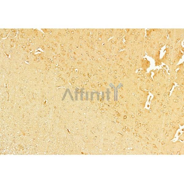 NLRP3 Antibody - DF7438 at 1/100 staining Rat brain tissue by IHC-P.