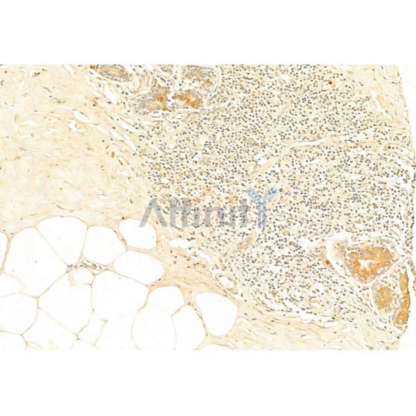 Phospho-Nrf2 (Ser40) Antibody - DF7519 at 1/100 staining Human normal tissues adjacent to mammary cancer by IHC-P.
