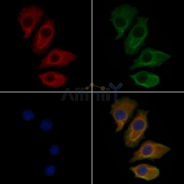 SCARF1 Antibody - DF7922 staining HepG2 cells by IF/ICC.