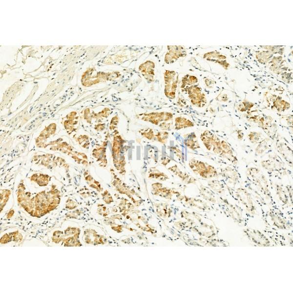 MUC2 Antibody - DF8390 at 1/100 staining Human normal tissues adjacent to gastric cancer by IHC-P.