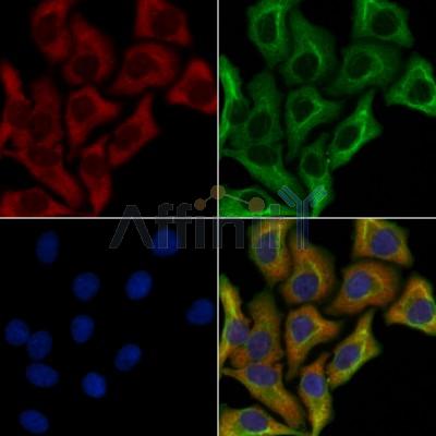 Ameloblastin Antibody - DF8503 staining Hela cells by IF/ICC.