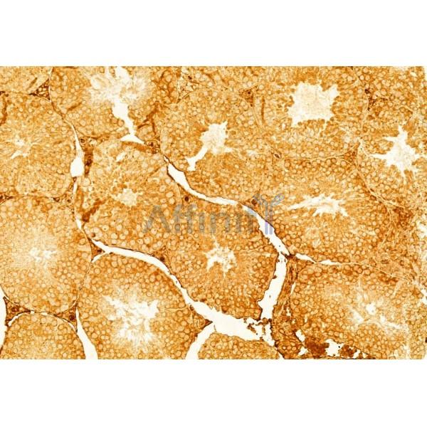 Ameloblastin Antibody - DF8503 at 1/100 staining Mouse testis tissue by IHC-P.