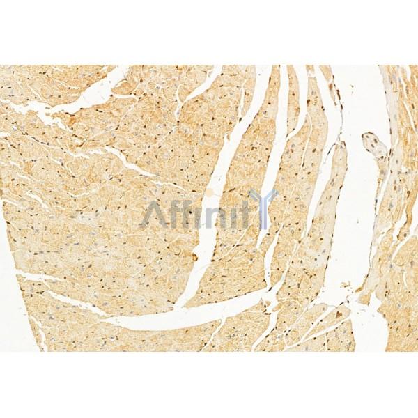 GnRH I Antibody - DF8553 at 1/100 staining Mouse heart tissue by IHC-P.