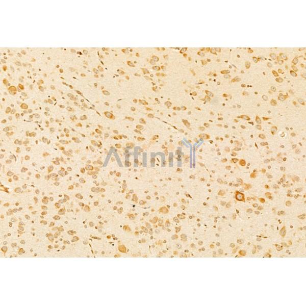 GnRH I Antibody - DF8553 at 1/100 staining Rat brain tissue by IHC-P.