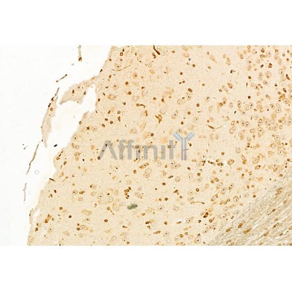 GnRH I Antibody - DF8553 at 1/100 staining Mouse brain tissue by IHC-P.